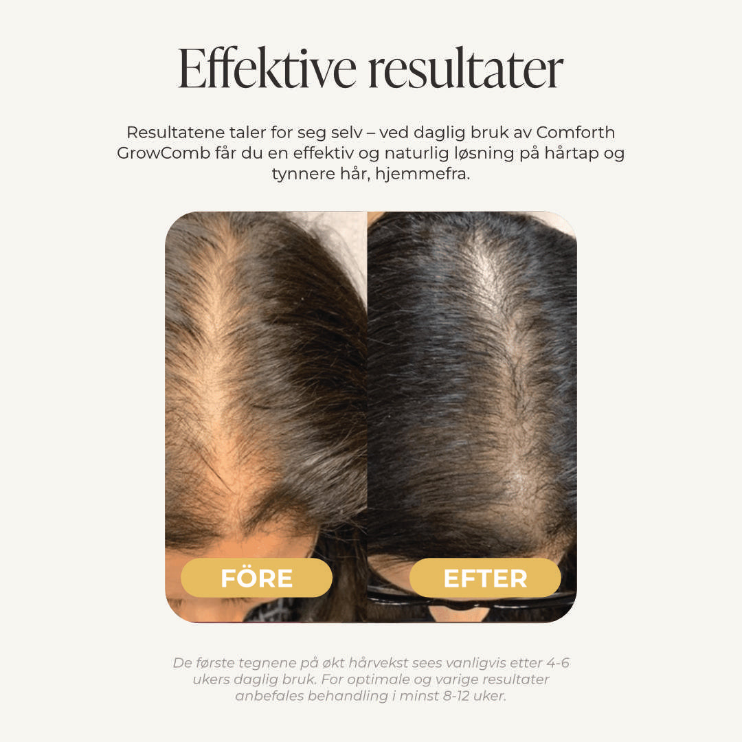 Comforth GrowComb – LED-hårvekstkam