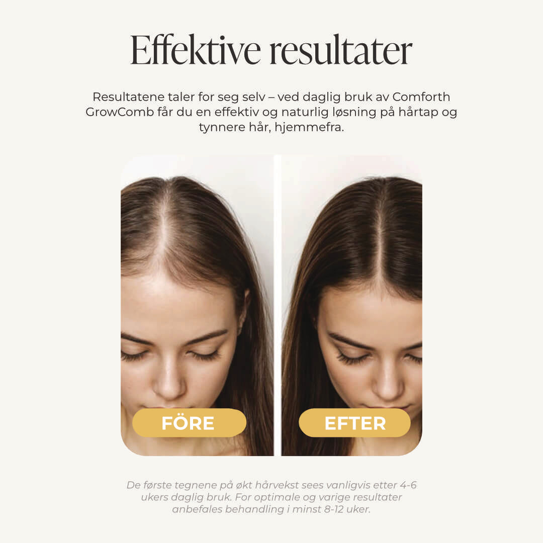 Comforth GrowComb – LED-hårvekstkam